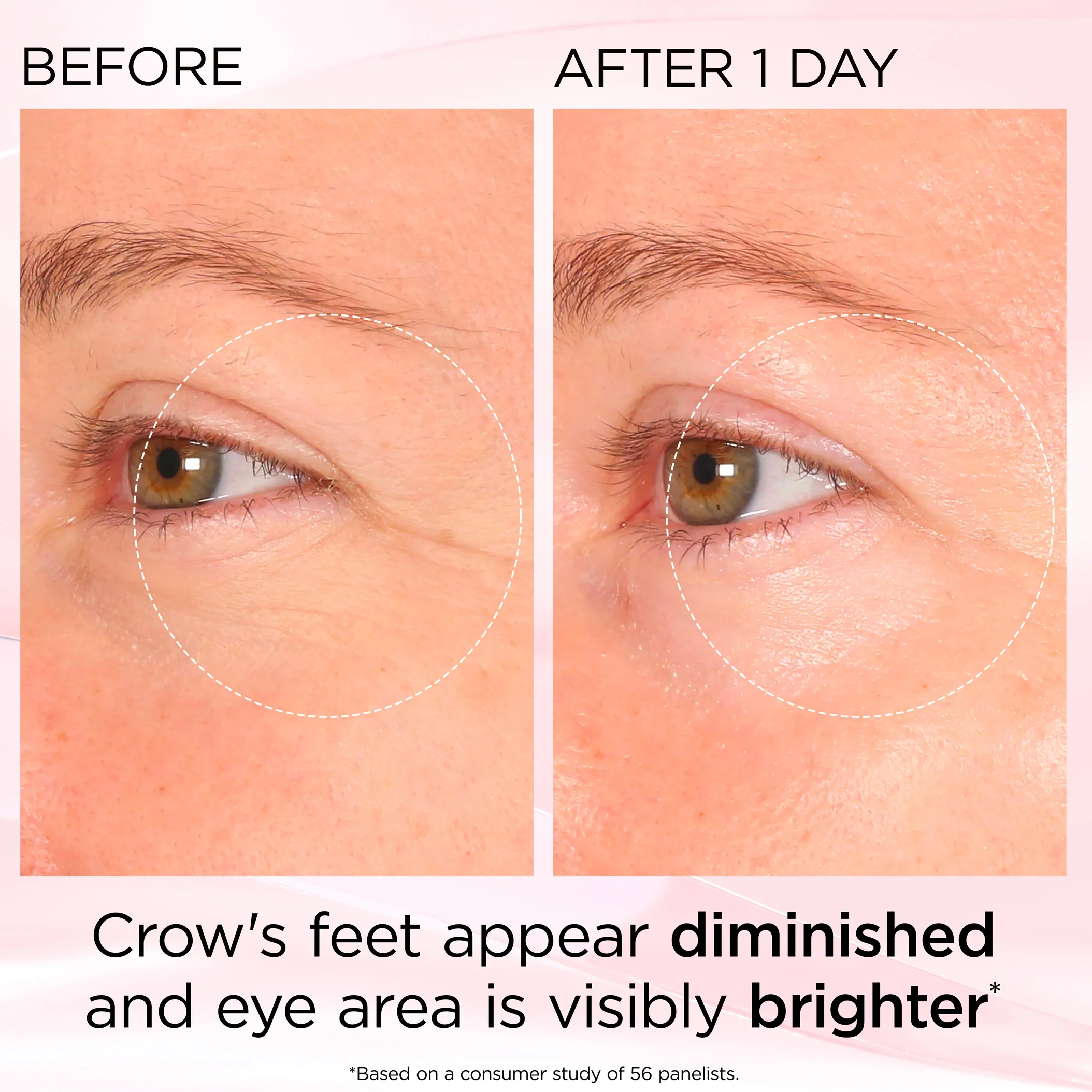 Retinol + HPR Ceramide Rapid Skin Renewing Eye Cream - Image 11
